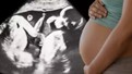 Tüp bebek merkezinde sperm skandalı! 3 çocuğun babası yabancı çıktı...