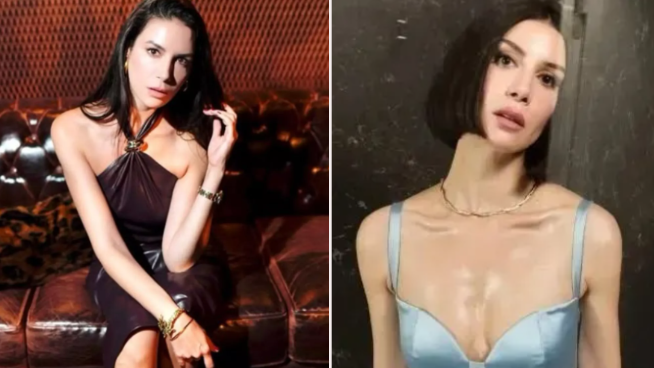 Beyin anevrizması geçirmişti: Ünlü oyuncu Ahu Yağtu hastane odasından paylaştı