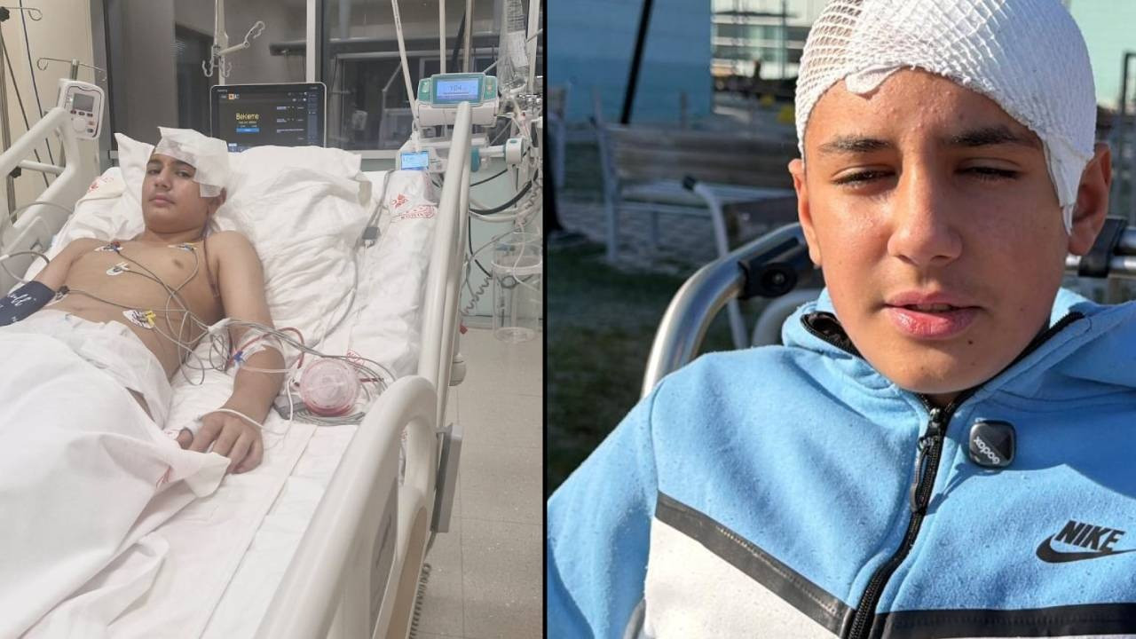 13 yaşındaki çocuğun kafatasını parçaladı! Tahliye sonrası paylaşımı pes dedirtti