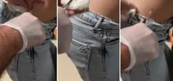 Kene kabusu Eskişehir'e sıçradı! Sırtına kene yapışan kadın hastanelik oldu
