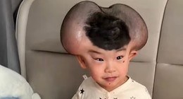 Mickey Mouse lakabıyla alay edilen küçük çocuğun inanılmaz dönüşümü