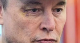 Elon Musk açıkladı: Oğlum gözümü morarttı! Trump'tan dikkat çeken ifadeler