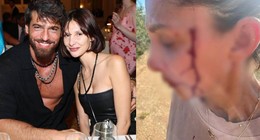 Can Yaman'ın sevgilisinden olay paylaşım: Şiddet görüyorum