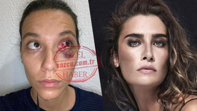 Ünlü isimlerden Ozan Güven’den şiddet gören Deniz Bulutsuz’a destek!