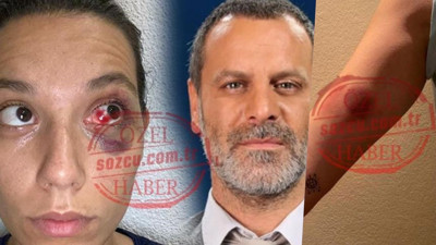 Deniz Bulutsuz'u darp eden Ozan Güven kendisini savundu: Saldırıya ben uğradım