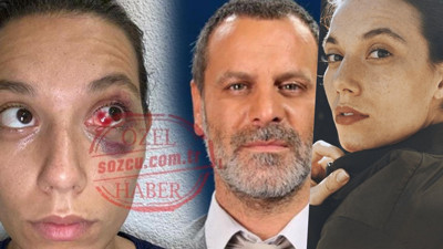 Ozan Güven ve Deniz Bulutsuz kavgasının detayları!