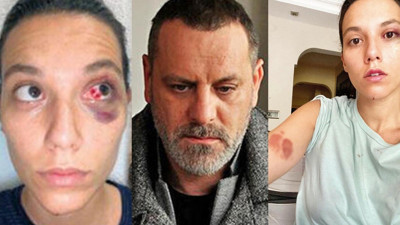 'Ozan Güven’in başı büyük dertte'