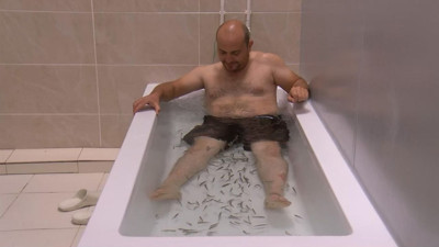 Sivas kangal balıkları ile alternatif tıp: Bu yöntemi ilk kez biz uyguladık!