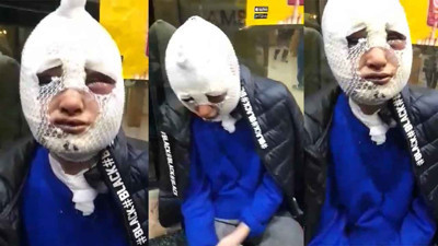 Hatay'da eski sözlüsünün evini basıp, cinsel saldırıda bulunan ve üzerine kızgın yağ döken şüpheli tutuklandı!