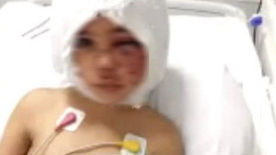 Gaziantep'te iki pitbull cinsi köpeğin saldırısına uğrayan 4 yaşındaki Asiye Ateş'in hastaneden gelen ilk resmi... Gaziantep Valiliği 3 kişinin tutuklandığını açıkladı.