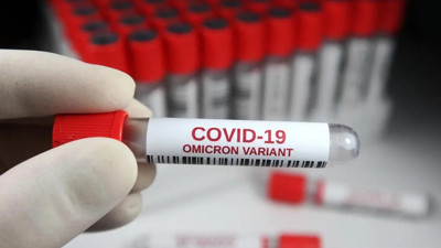 Omicron varyantının en çok etkilediği grup belli oldu! Uzmanlardan 'hafife almayın' uyarısı