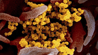 Yeni salgın ve virüs paniği... İngiltere’de Ebola benzeri virüs tespit edildi