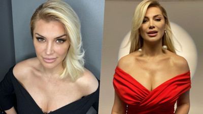 Songül Karlı estetik sonrası bambaşka biri oldu! Son hali nefesleri kesti