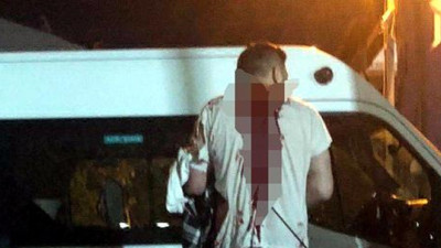 Tartıştığı ağabeyini önce bıçakladı sonra zıpkınla vurdu!