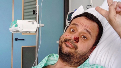 Maymun Çiçeğine yakalanan Türk tek tek anlattı: Sanırım öleceğim