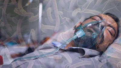 Sudan'da kolera salgını nedeniyle ölenlerin sayısı 48'e yükseldi