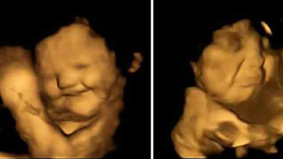 Şoke eden araştırma: Hamile kadına lahana yedirildi, sonra da karnındaki bebek görüntülendi! Anne karnındaki bebeğin tepkisi olay oldu