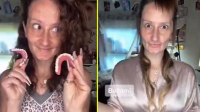 Böyle değişim görülmedi! Son halini görenler şaşkınlıklarını gizleyemiyor