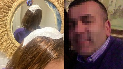 Uzaklaştırma kararı bulunan karısının evini bastı tabanca kabzasıyla darbetti! Eşine ateş ederek kaçan müteahhit polise teslim oldu