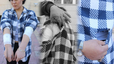 Üniversite öğrencisine köpekler saldırdı. 20 yaşındaki Kübra dehşeti yaşadı çevredekiler kurtardı sırtından, başından ve kollarından yaralandı