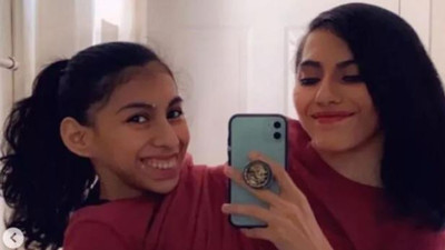 Yapışık ikizlerden cinsel ilişki itirafı...