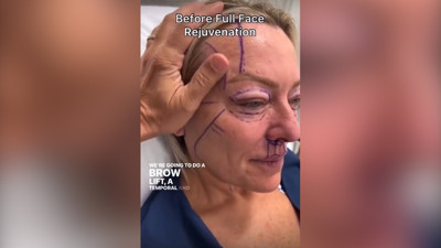 Yaşlı bir kadının estetik yaptırmadan önceki ve sonraki hali sosyal medyada gündem oldu