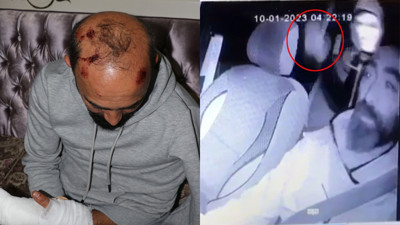 Taksi şoförüne taşla saldırıp kafasını yaran saldırgan tutuklandı