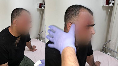 Gazeteci Sinan Aygül'e saldırı. Belediye Başkanından açıklama geldi