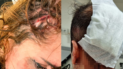 Eğlenmeye gittiler, ölesiye dayak yediler! İstanbul'un göbeğinde korkunç olay! Bir kadının kafasında şişe patlattılar