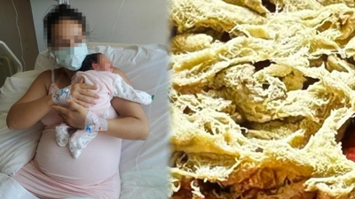 Sezeryandan sonra hayatı zehir oldu. 2 yıldır ağrı çeken kadının vücudundan bakın ne çıktı