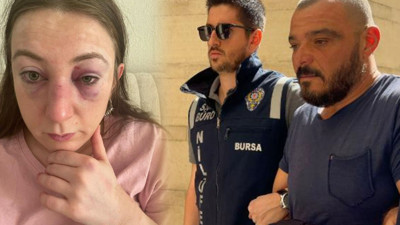 Eğlence merkezinde gördüğü eski sevgilisine 9 kez kafa attı: Zorla otomobile bindirip burada 9 kez eski sevgilisine kafa atan zanlı için 9 yıl hapis cezası istendi