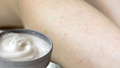 Bacaktaki batıklardan eser kalmayacak: Her evde bulunuyor batıkları kökten bitiriyor. Bacaktaki batıklar nasıl geçer?