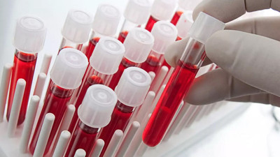 Bilim insanları büyük bir keşfe imza attı: Yeni bir kan grubu ortaya çıktı