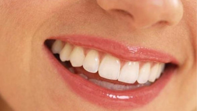 Diş renginin değişmesinin bir nedeni de meğer buymuş: Kullanmadan önce bir kez daha düşünün