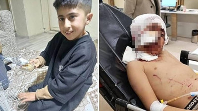 Adres bu kez Erzurum oldu. 10 yaşındaki çocuğa köpekler saldırdı! Hayati tehlikesi var!
