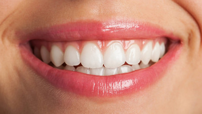 Hemen diş etinizi kontrol edin: Kemik erimesiyle karşı karşıya olabilirsiniz