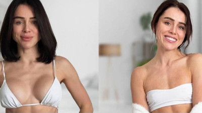 Ünlü isim slikonları çıkardı! Yeni bir akım başladı... Yüzlerce mesaj aldı