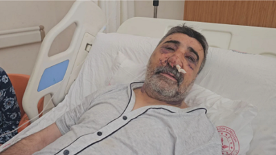 İngiliz boksörün darp ettiği taksici konuştu: Isırmaya, öpmeye başladı