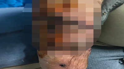 Köpekler dehşet saçtı! Parça parça ettiler. Koluna 40, bacağına 36 dikiş atıldı