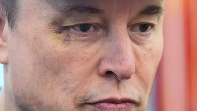 Elon Musk açıkladı: Oğlum gözümü morarttı! Trump'tan dikkat çeken ifadeler