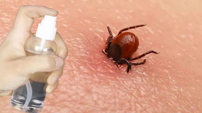Kene savar doğal yöntem bulundu: Bunu sıkana kene yapışmıyor