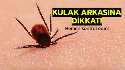 Kulağınızın arkasında kene olabilir! Kenelerin vücuda en çok yapıştığı bölge belli oldu