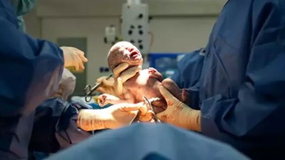 Özel hastaneler için yeni karar! Planlı sezaryen doğum yasaklandı