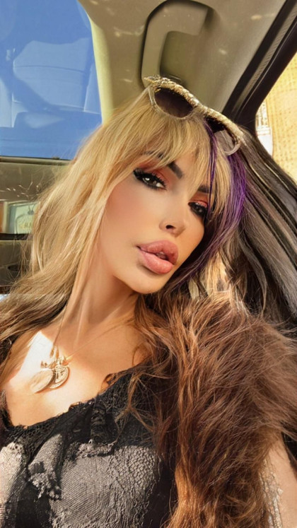 Estetik hastalığına kapıldı, bu hale geldi. Agresif Seyhan Soylu gitti, yerine Gülen Yüz Sisi geldi! Estetikte Ajda Pekkan'ın rekorunu kıran Soylu, yine bıçak altına yattı. İşte Sisi'nin son hali - Resim : 5