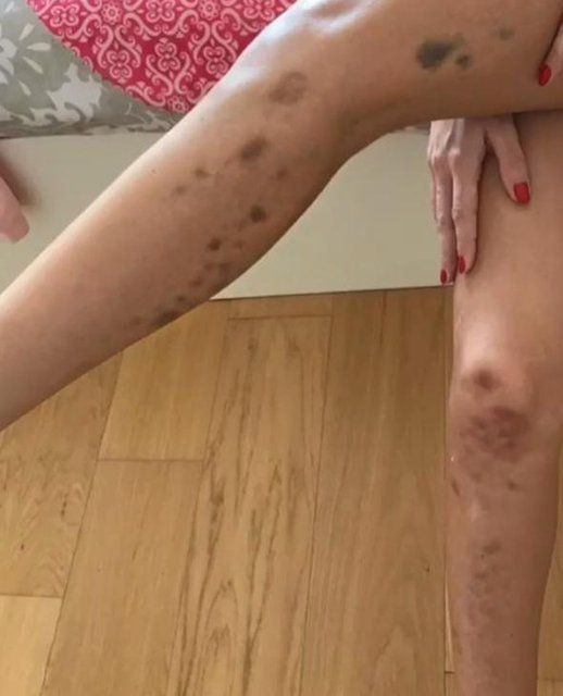 Ünlü şarkıcı yaşadığı zor günleri anlattı - Resim : 7