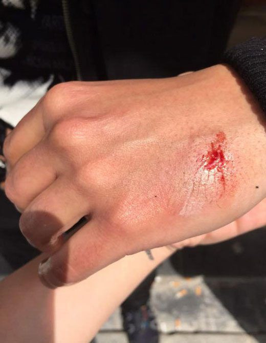 Emrah Serbes 1 Mayıs yürüyüşünde yaralandı!