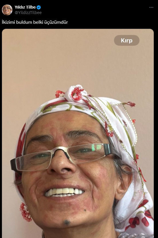 Yıldız Tilbe'nin paylaşımı sosyal medyayı yıktı geçti