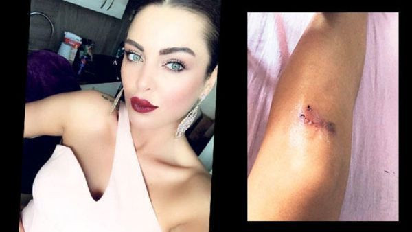 Sinem Umaş ile polisin bira tartışması karakolda bitti! Emniyetten açıklama