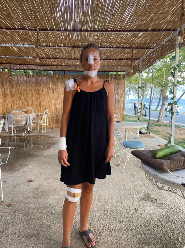 Balıkesir'de başı boş köpekler dehşet saçtı. Anne ile kızı ölümden döndü