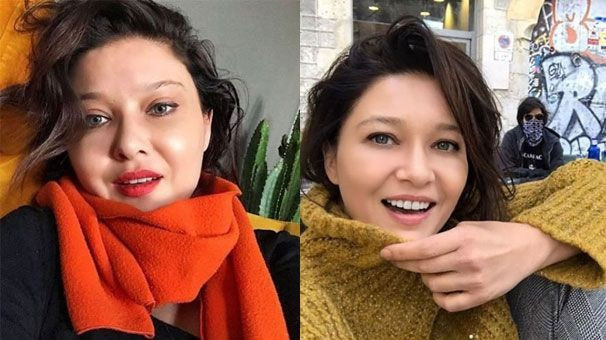 Nurgül Yeşilçay botoksuyla şoke etti!